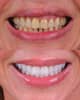Slider image (10) Best Dental Clinic in Istanbul - Niva Aesthetic